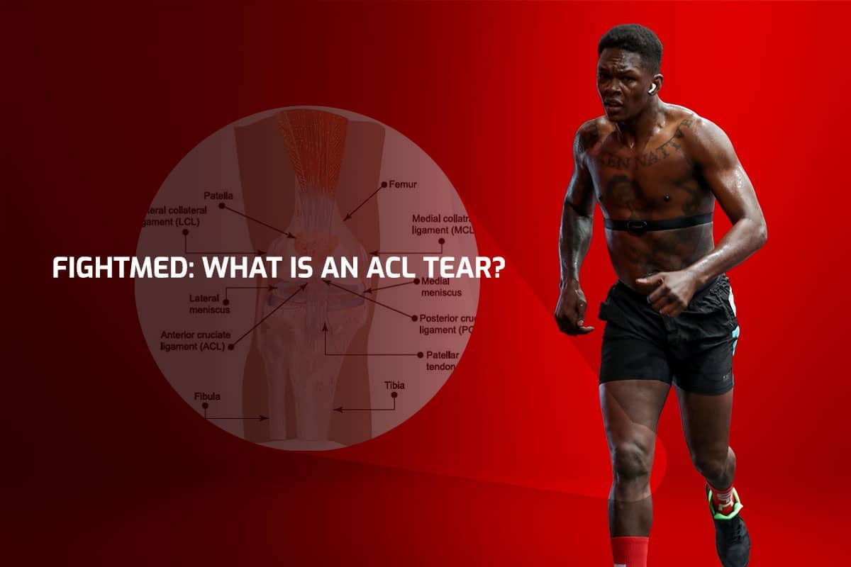 FightMed: What is an ACL tear?